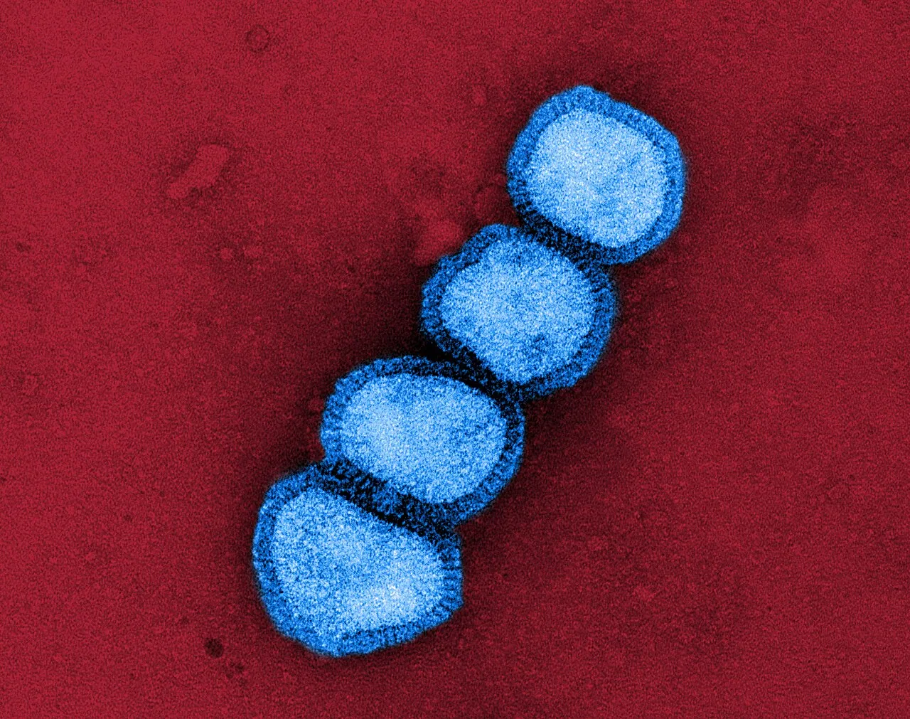H1N1 (domuz gribi) virüsünün elektron mikroskobu görüntüsü